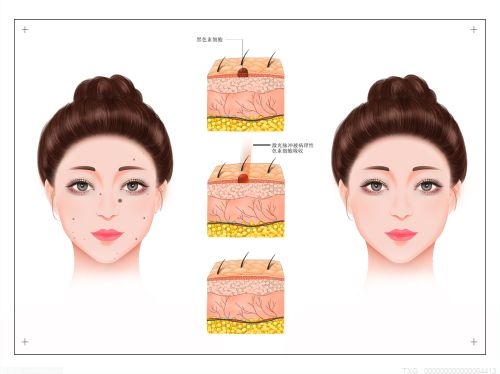 冬天如何洗脸 冬天如何洗脸防止干燥？